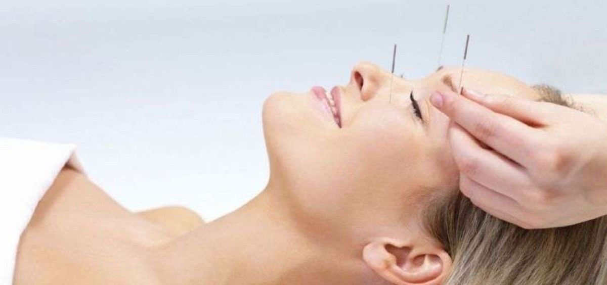 Akupunktur uygulamaları