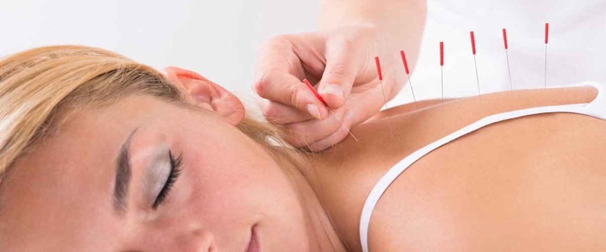 Akupunktur uygulamaları